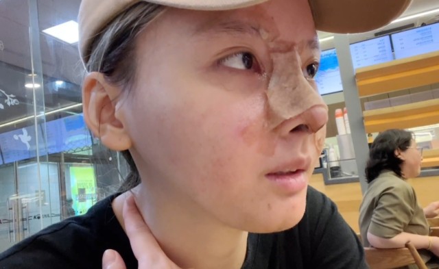 哈妮하니 是發生什麼事?